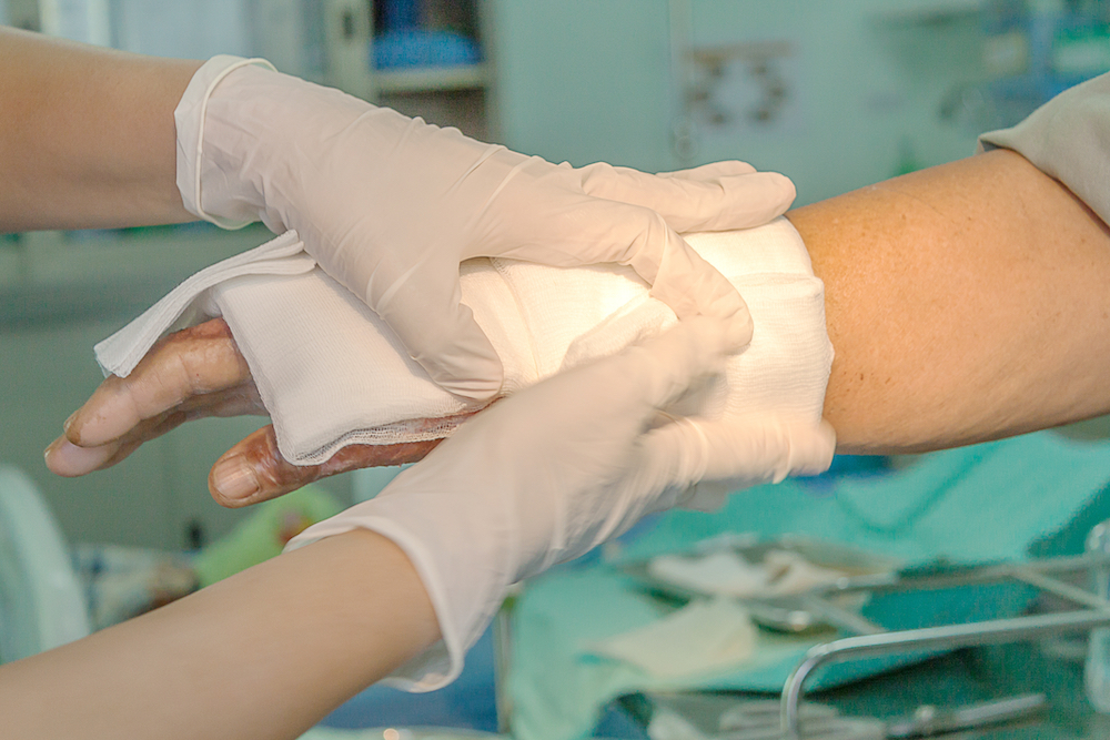 Dressing burned wounded hand with gauze pad