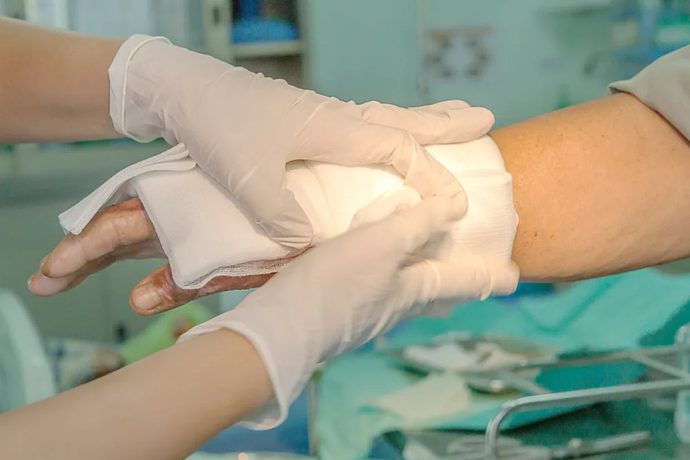 Dressing burned wounded hand with gauze pad